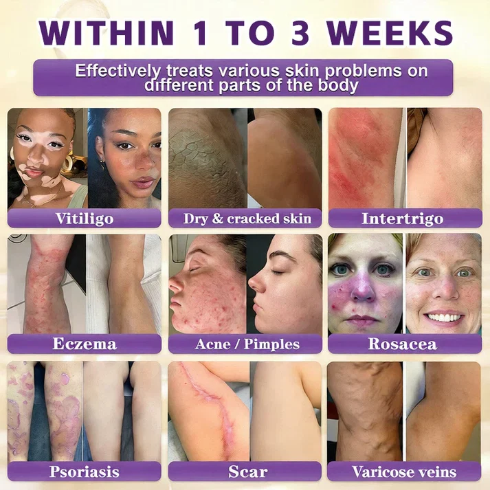 Limited-time offer: 70% off ⬇️Elivessa™ Biotin 10-in-1 Skin Restoration Cream