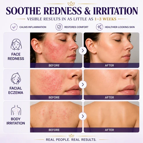 Limited-time offer: 70% off ⬇️Elivessa™ Biotin 10-in-1 Skin Restoration Cream