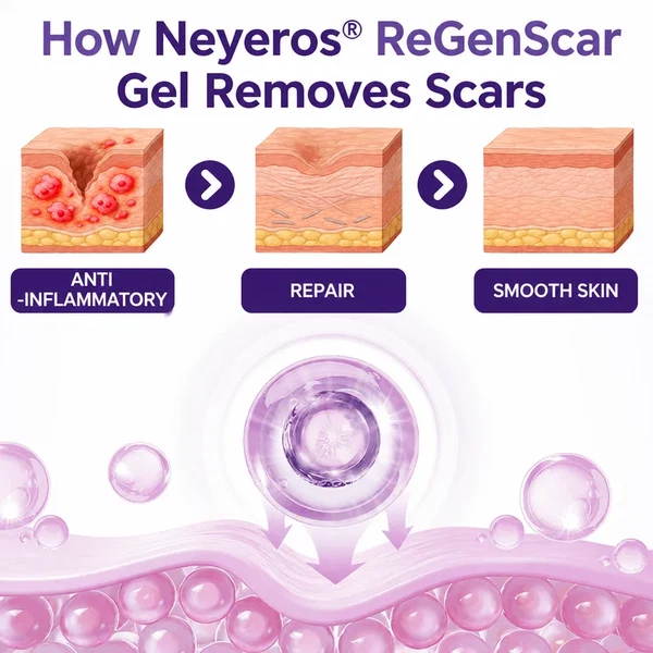 Neyeros® ReGenScar Stem Cell Scar Gel