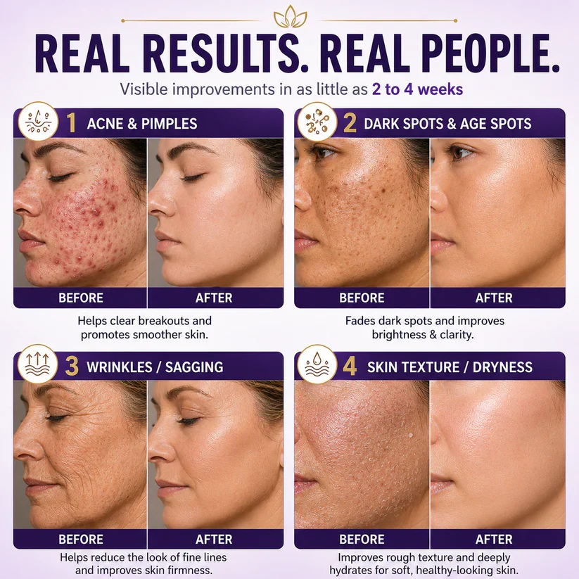 Limited-time offer: 70% off ⬇️Elivessa™ Biotin 10-in-1 Skin Restoration Cream