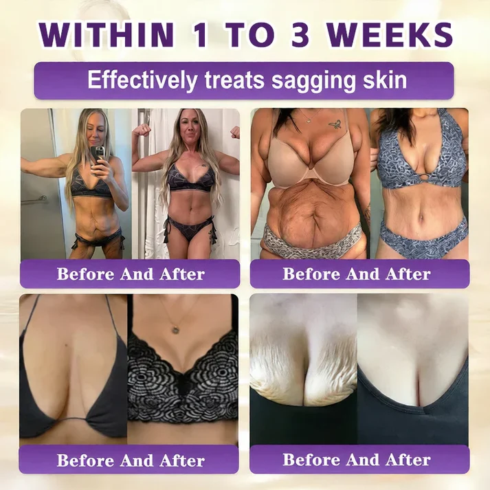 Limited-time offer: 70% off ⬇️Elivessa™ Biotin 10-in-1 Skin Restoration Cream