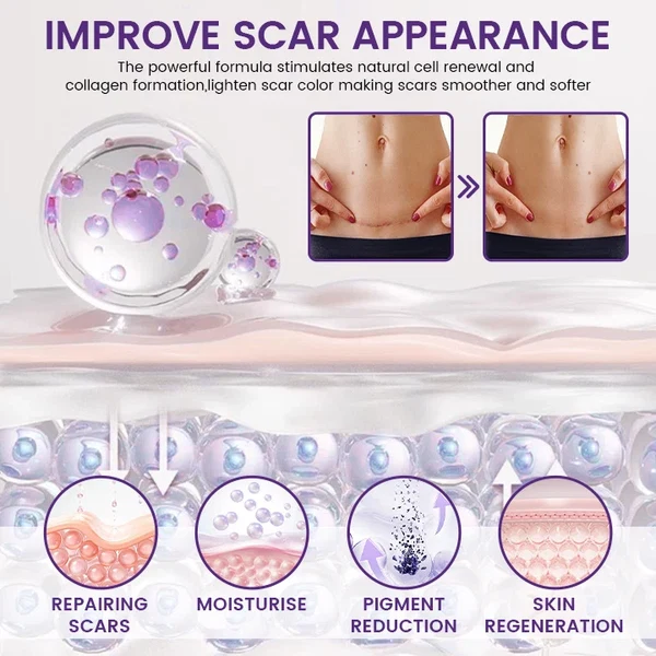 Neyeros® ReGenScar Stem Cell Scar Gel